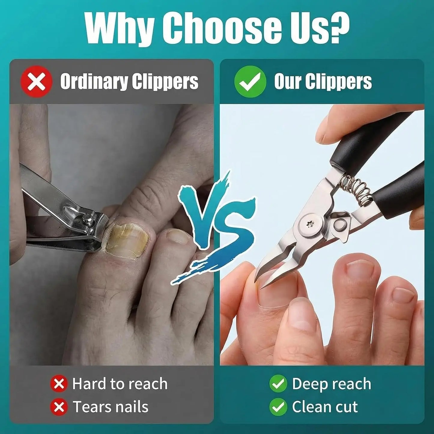 Stainless Steel Toenail Clippers for Thick & Ingrown Nails - Concave Edge Curved Blade, 30° Sharp Precision Trimming