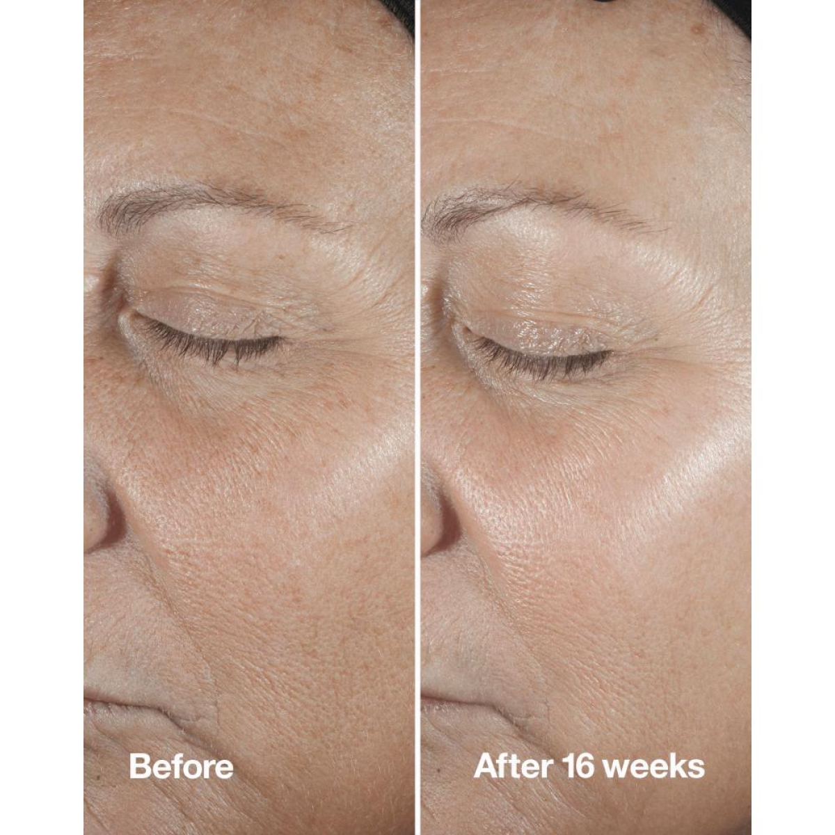 Clinique Smart Clinical Repair Wrinkle Correcting Serum 50ml
