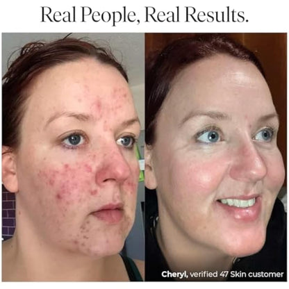 47 Skin Anti-blemish & scar repair Elixir enriched with Silver Chitoderm for All Skin Types, 100ml
