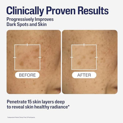Cetaphil Healthy Radiance Brightening Serum with Niacinamide for Skin Pigmentation, 30ml