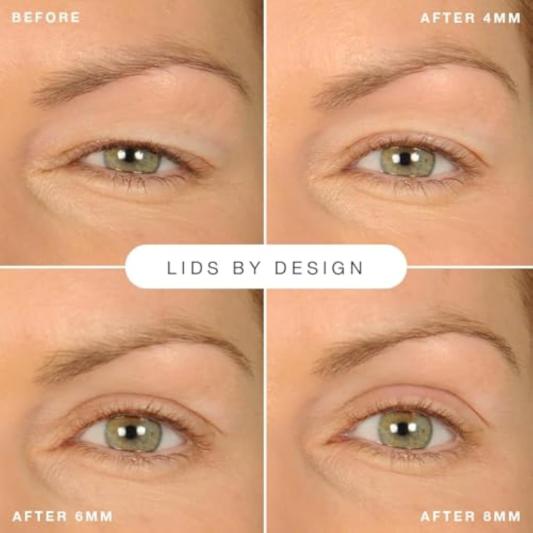 Contours Rx Lids by Design Eyelid Lift Strips with Travel Case and Tweezers - Invisible Eyelid Tape for Hooded Eyes - a Youthful-Looking Appearance - 2 Pack - 160 CT (5mm)