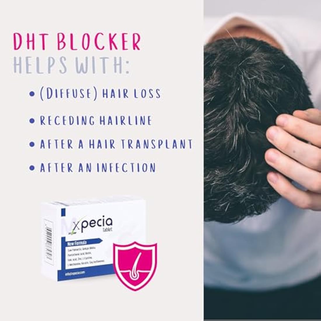 XPECIA FOR MEN ANTI HAIR LOSS DHT BLOCKER NEW HAIR GROWTH FORMULA (180 Tablets)