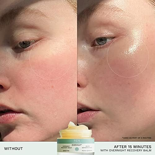 REN Clean Skincare Evercalm™ Overnight Recovery Balm | Intensively Nourishes Skin Barrier to Hydrate & Soothe during Sleep | Calms Red or Irritated Skin | Cruelty Free | Step 4: Recover