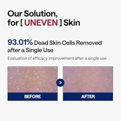 MEDIHEAL Phyto Enzyme Peeling Pad - Vegan Face Resurfacing Gauze Pads with LHA & Papaya Enzym - Pore Tightening Pads to Control Sebum - Exfoliating Pads for Dead Skin Cells, 90 Pads