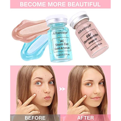 Kybbe Foundation Liquid for Needling System Semi Permanent Base Concealer Waterproof Glow