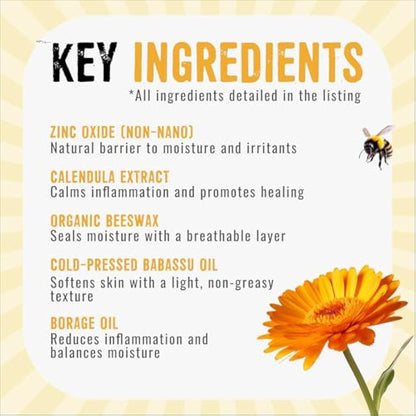 Zinc and Calendula Cream 100% Natural - for perioral dermatitis, rosacea, acne, nappy rash cream, spots, blemishes, breakouts, rashes 120ml