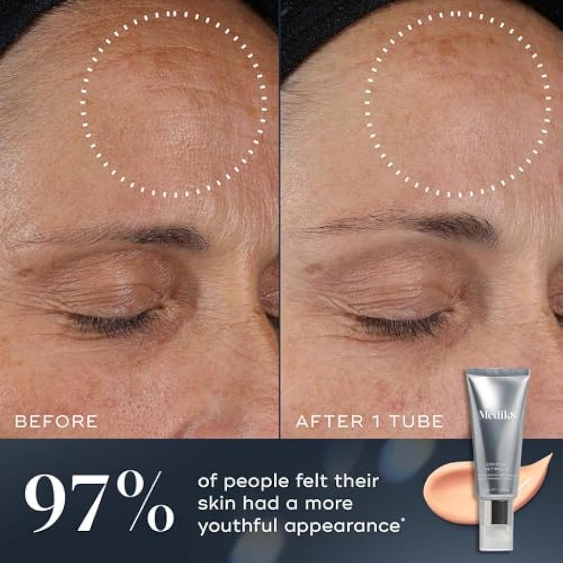 Medik8 Crystal Retinal 10 - Age-Defying Retinal Night Serum - Improves Wrinkles & Skin Firmness- 0.1% Retinal Strength - 11x Faster than Retinol - For Advanced Vitamin A Users - 30ml