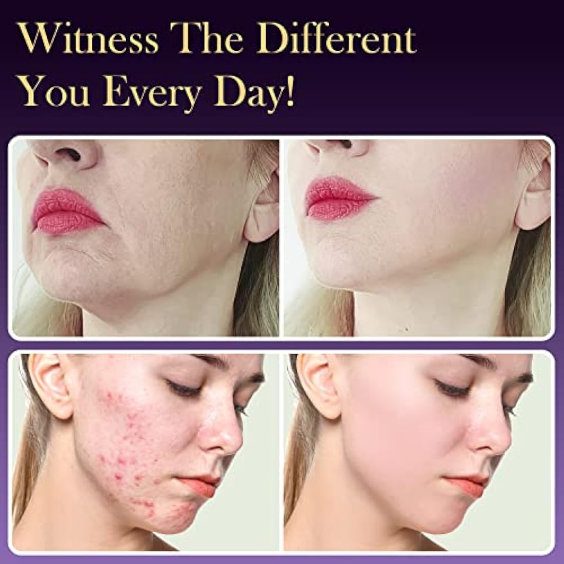 High Frequency Wand - TUMAKOU 6 IN1 Portable Argon High Frequency Facial Skin Tightening Machine - Purple Light Therapy Electrode Face Device for Acne,Wrinkle,Hair - with Different 6 Glass Tubes