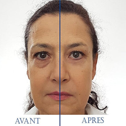 SKINEANCE - Magic Serum - Eye contour tensing effect - Smoothes fine lines and wrinkles - Reduces puffiness under the eyes - Acts in less than 3 minutes - Effective 8 to 10 hours - 5 tubes of 2 ml...