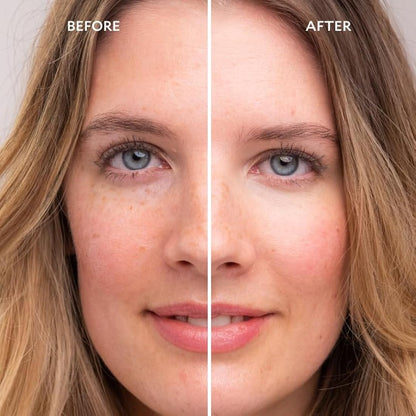 Gatineau - Miracle Eye & Face Contour Cream (11ml), Conceal Dark Circles, Hydrating with Hyaluronic Acid & Vitamin E
