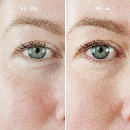 Gatineau - Miracle Eye & Face Contour Cream (11ml), Conceal Dark Circles, Hydrating with Hyaluronic Acid & Vitamin E