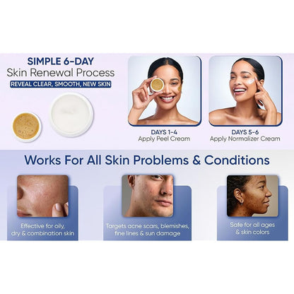 SKIN CULTURE PEEL 4000 - Skin Peeling Kit | Created in1937 | Gets rid of acne scars, blemishes, large pores, fine lines, sun damage in only 6 days!