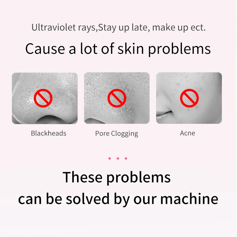 ANLAN Ultrasonic Skin Scrubber Deep Cleaning Peeling Shovel Limpiador Facial Skin Care Face Lifting Machine Ultrasonic Cleaner