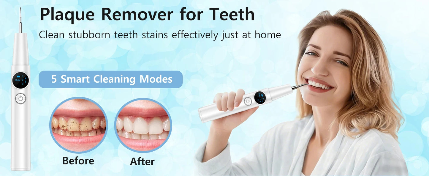 Electric Dental Tartar Remover Ultra Sonic Dental Calculus Remover Plaque Removal for Teeth Dental Scaler Tartar Eliminatorr