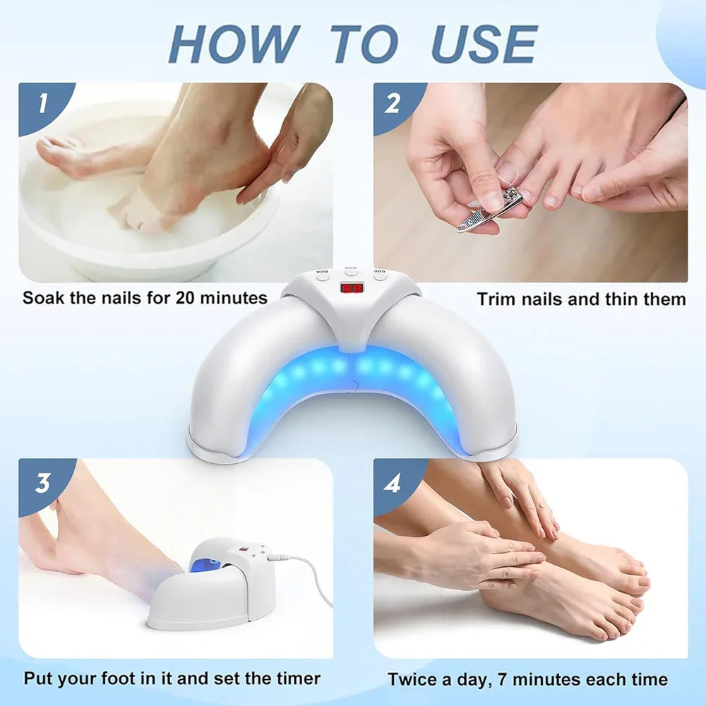 New Fungal Nail Laser Device Repair Toenail Fingernail Treatment Anti Fungus Infection Paronychia Onychomycosis Ingrown Toenail