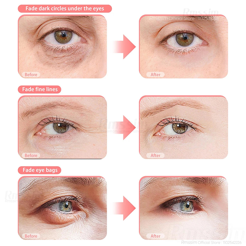 Eye Massager 3D Red Light EMS Eyes Relax Massager Fatigue Relief Lighten Dark Circles Smooth Eye Fine Line Beauty Eye CareDevice