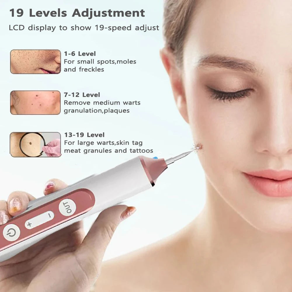 Skin Tag Remover Wart Eliminator Laser Plasma Pen Papillomas Electric Freckle Dark Spot Mole Removal Skin Tag Remover Pen
