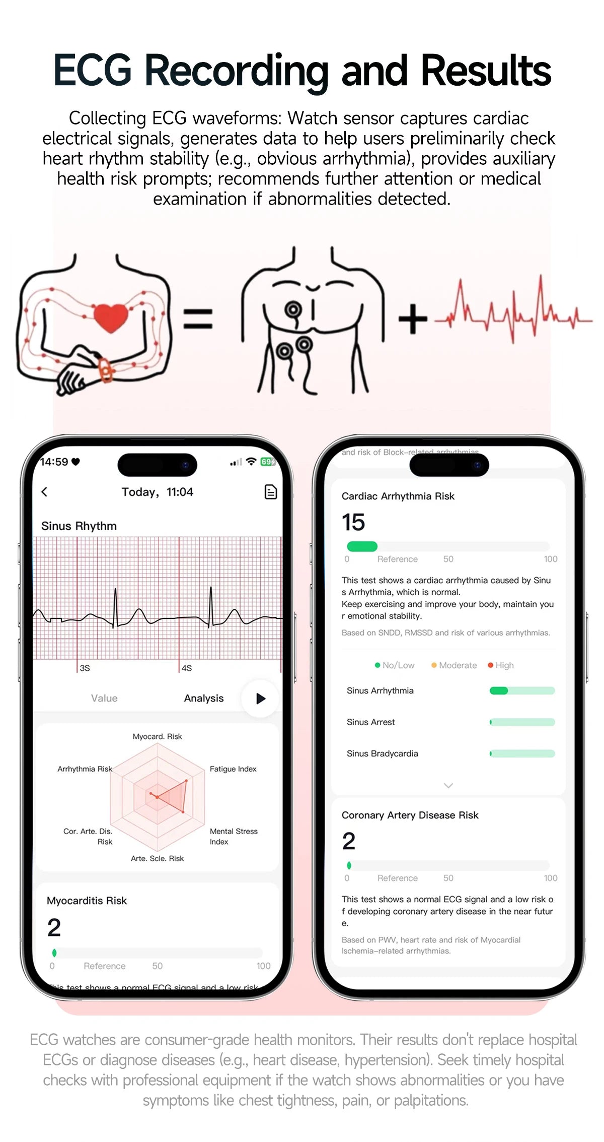 2026 New Accurate Diagnosis Smart Watch ECG Blood oxygen BP Uric acid Lipids Health HD AMOLED Screen call Smart watch Men Women