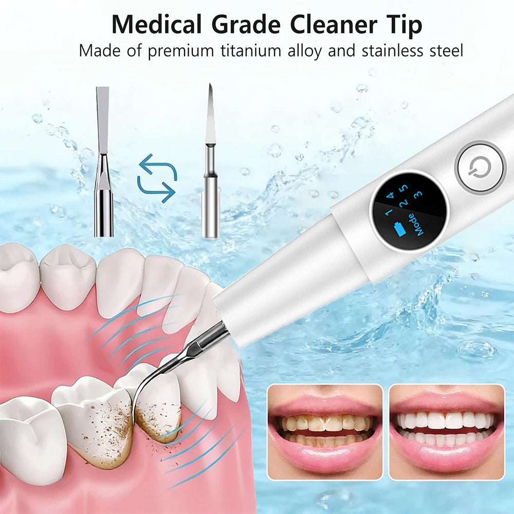 Electric Dental Tartar Remover Ultra Sonic Dental Calculus Remover Plaque Removal for Teeth Dental Scaler Tartar Eliminatorr