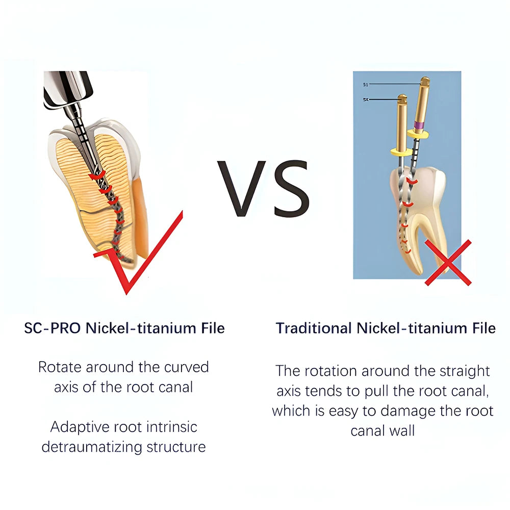 COXO SOCO PRO Dental Root Canal File Heat-Activated Rotary Nitinol Tooth Pulp Files Thermally Activated Nickel-Titanium 6Pcs/Box