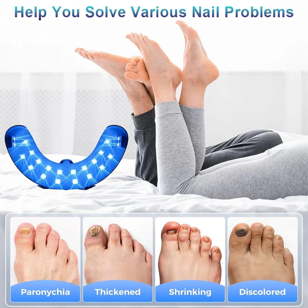 New Fungal Nail Laser Device Repair Toenail Fingernail Treatment Anti Fungus Infection Paronychia Onychomycosis Ingrown Toenail