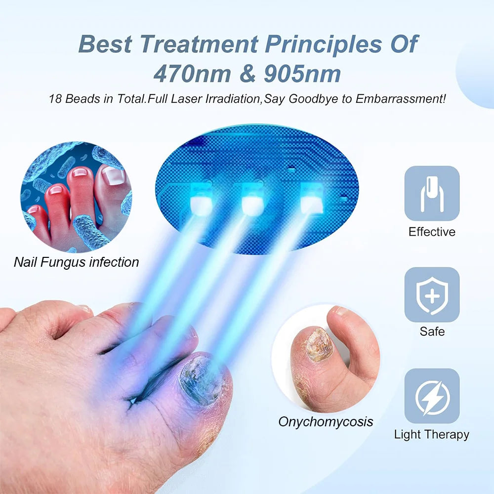 New Fungal Nail Laser Device Repair Toenail Fingernail Treatment Anti Fungus Infection Paronychia Onychomycosis Ingrown Toenail