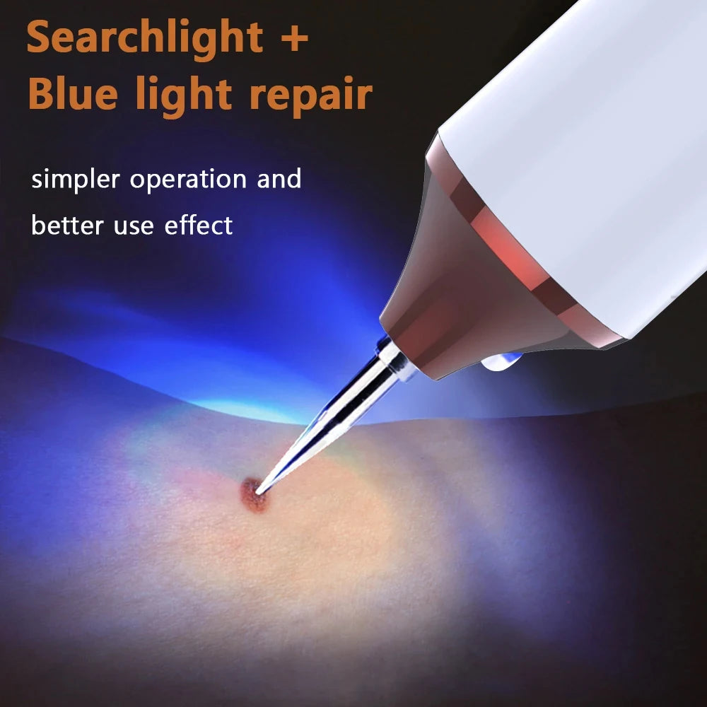 Skin Tag Remover Wart Eliminator Laser Plasma Pen Papillomas Electric Freckle Dark Spot Mole Removal Skin Tag Remover Pen