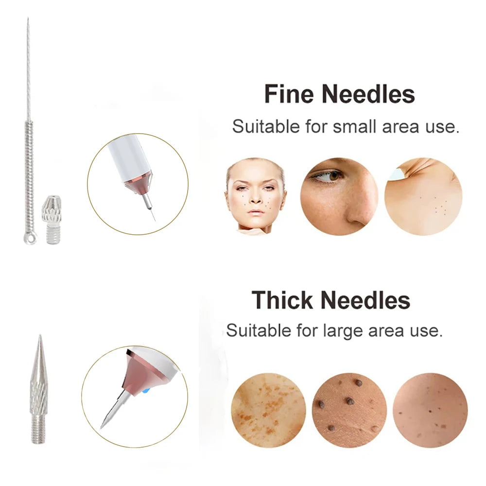 Skin Tag Remover Wart Eliminator Laser Plasma Pen Papillomas Electric Freckle Dark Spot Mole Removal Skin Tag Remover Pen